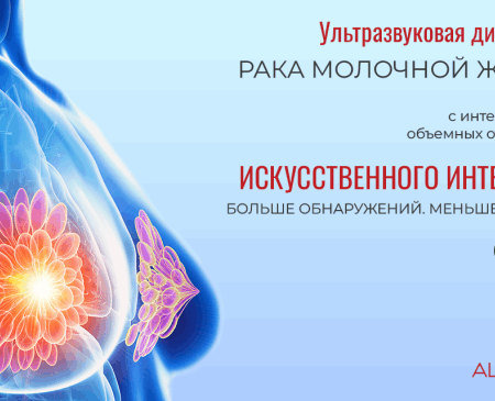 Искусственный интеллект: Новый взгляд на диагностику рака молочной железы
