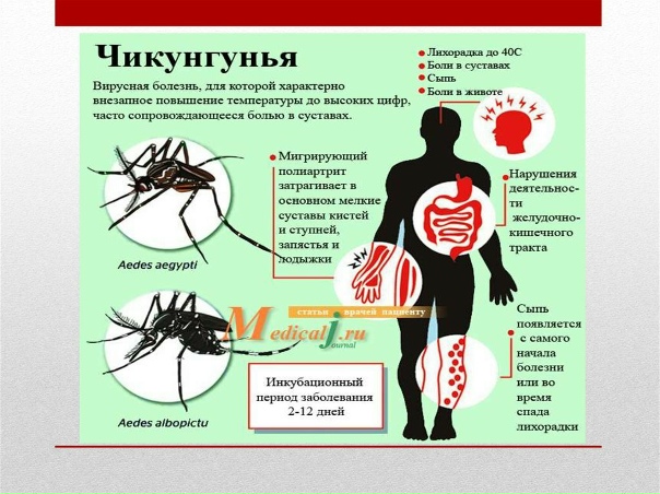 Preview Могут ли россияне заразиться лихорадкой чикунгунья