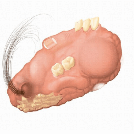 Удивительная находка: киста с волосами у пенсионерки из Подмосковья