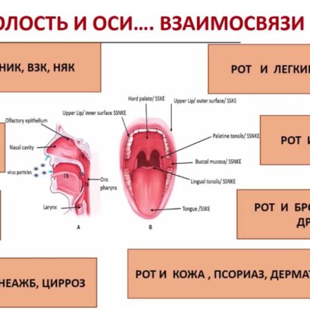 Неожиданная связь: Ротовая полость и инфаркт