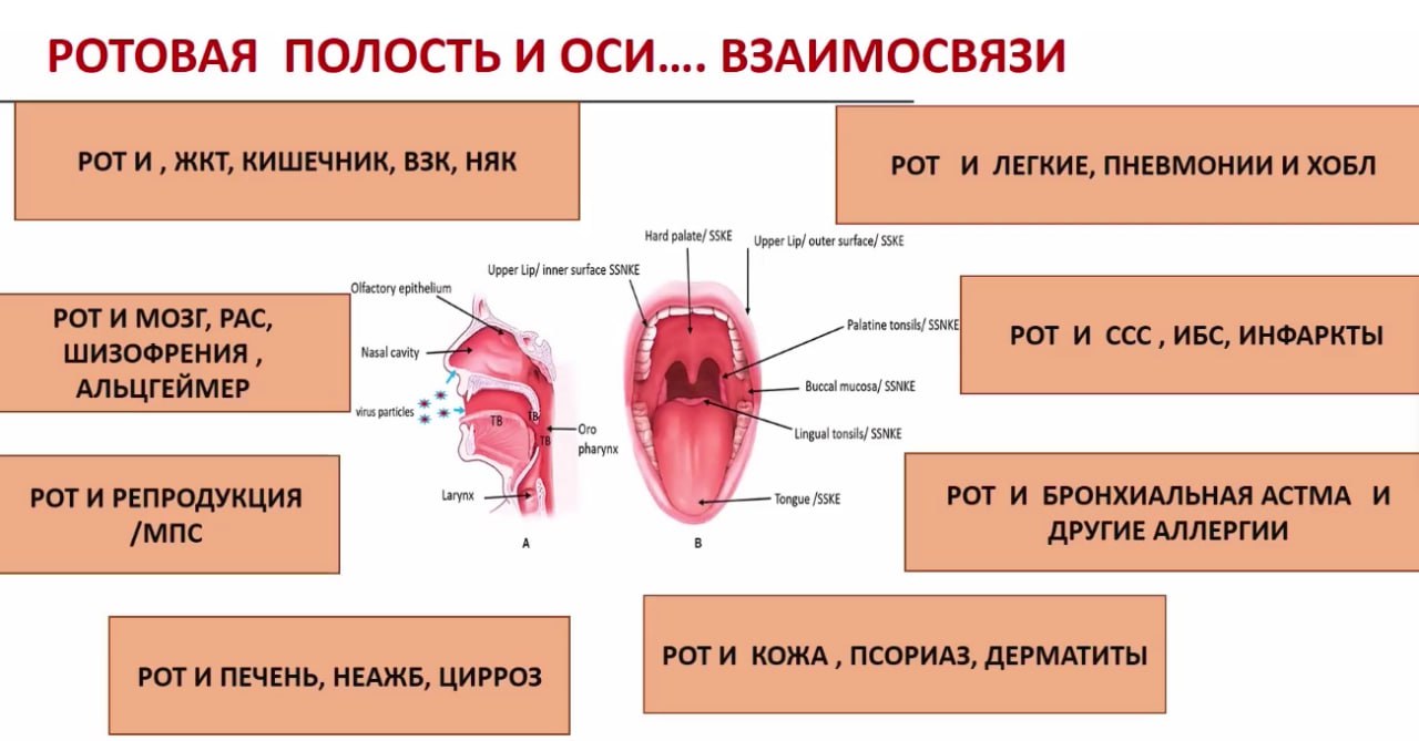 Preview Неожиданная связь: Ротовая полость и инфаркт