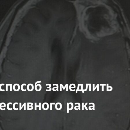 Обнаружен метод замедления роста агрессивного рака мозга