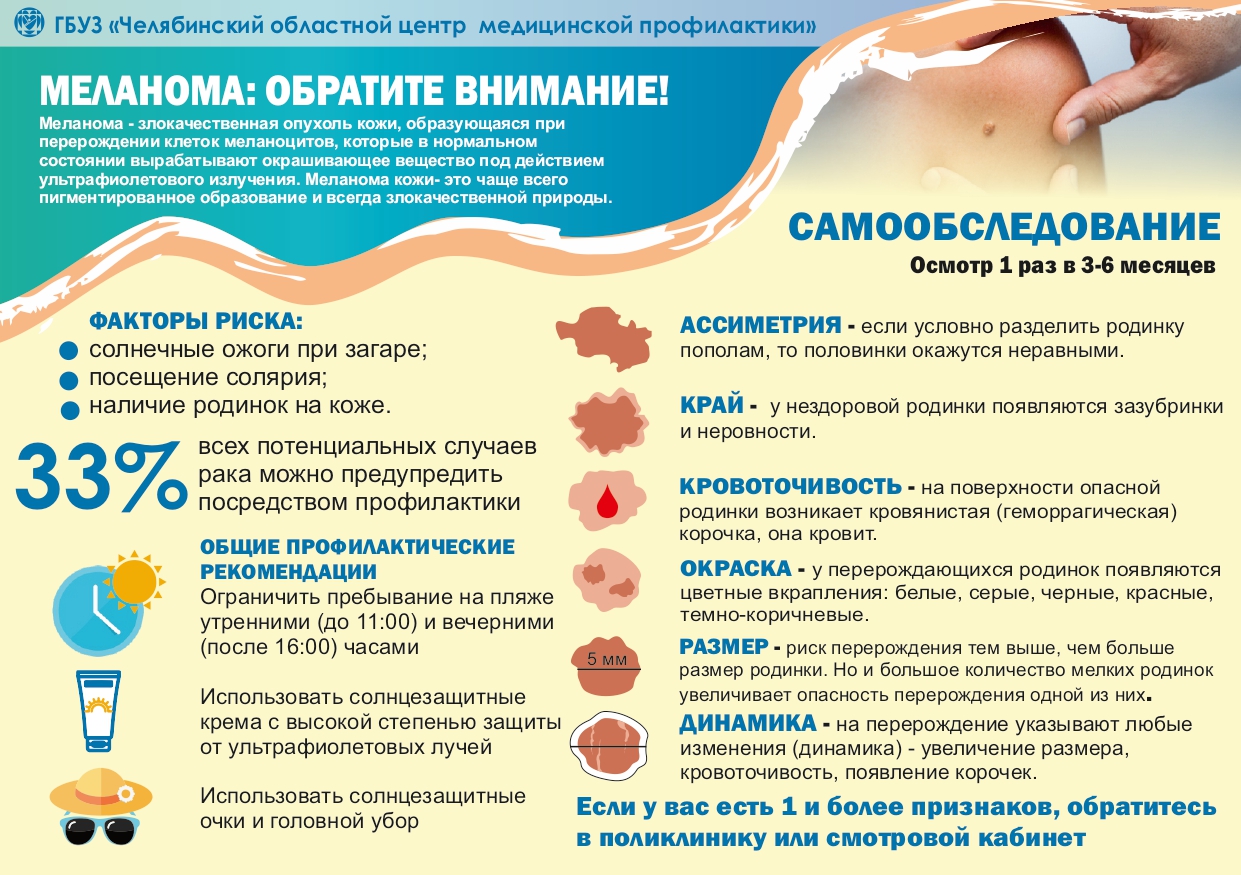 Preview Меланома: осенний пик заболеваемости и важность ранней диагностики