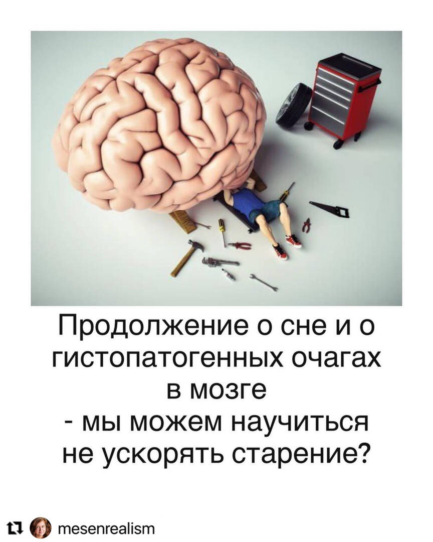 Preview Некачественный Сон Ускоряет Старение Мозга: Новые Научные Данные