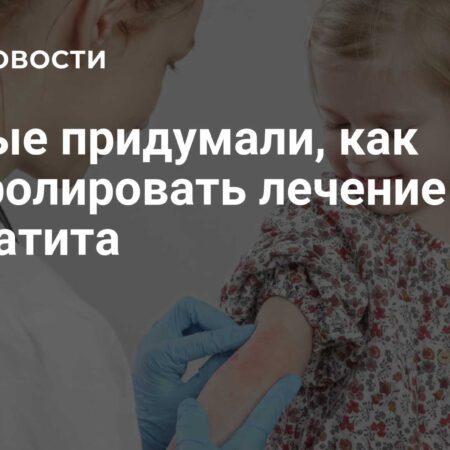 Ученые разработали новый способ контроля лечения дерматита