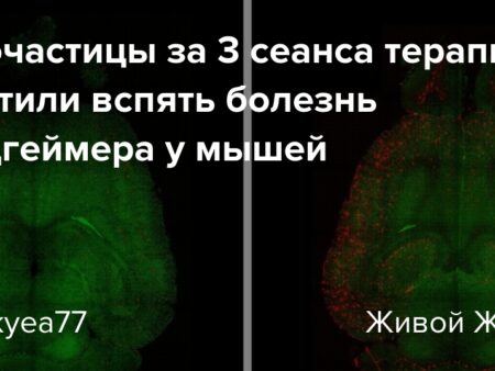 Революция в борьбе с Альцгеймером: наночастицы обращают болезнь вспять
