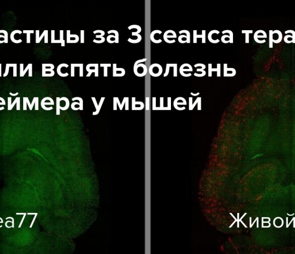 Революция в борьбе с Альцгеймером: наночастицы обращают болезнь вспять