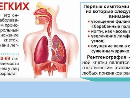 Обнаружен революционный метод выявления риска рака легких у некурящих