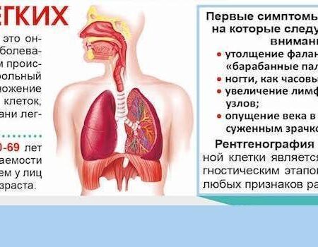 Обнаружен революционный метод выявления риска рака легких у некурящих