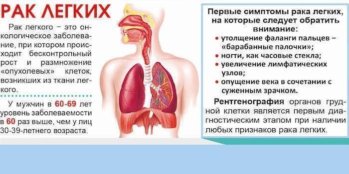 Preview Обнаружен революционный метод выявления риска рака легких у некурящих