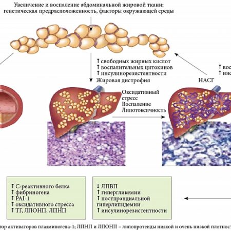 Мутации в клетках крови: новая причина ожирения, диабета и жирового гепатоза