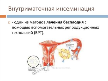 Прорыв в лечении бесплодия: мРНК-технология подарила надежду
