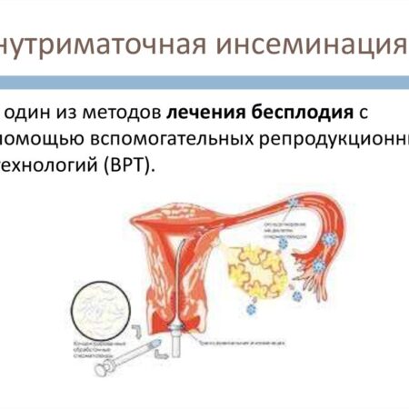 Прорыв в лечении бесплодия: мРНК-технология подарила надежду